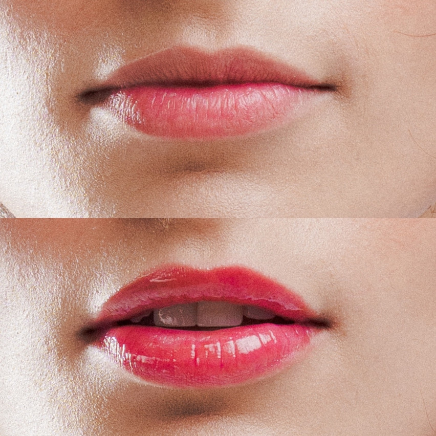 Lip Treats